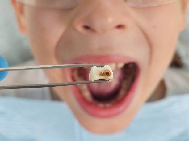 Best Weekend Emergency Dentist in Lake Mathews, CA